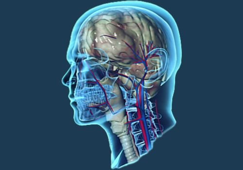 2 - Advanced Body Scan | Early Detection CT Heart & Cancer Screening