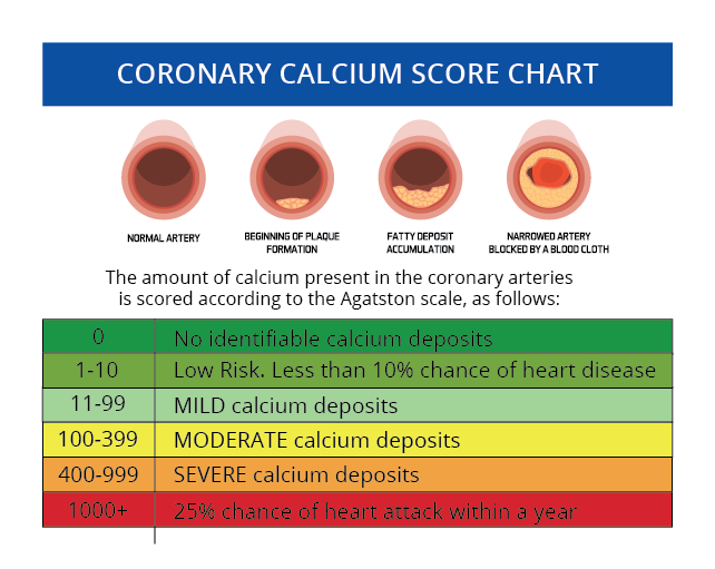 Calcium Score - Heart & Cancer Screening CT Scan - Dallas, Houston, OKC