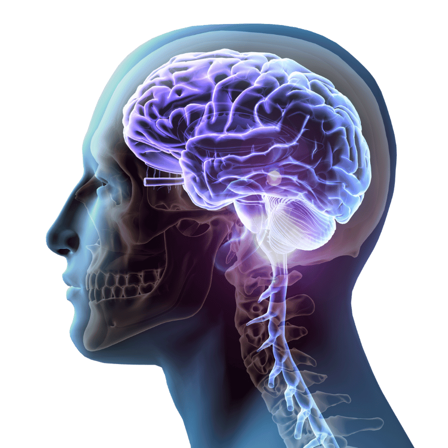 Advanced Body Scan Brain MRI MRA with AI — brain scan early detection